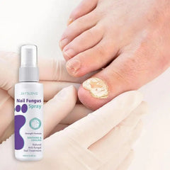 Nail Fungus Curing Spray